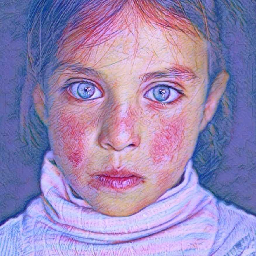 ايڤا