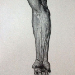 Arm