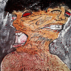 Schizophrenia