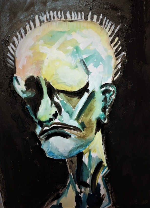 Schizophrenia